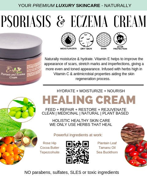 Psoriasis and Eczema Cream
